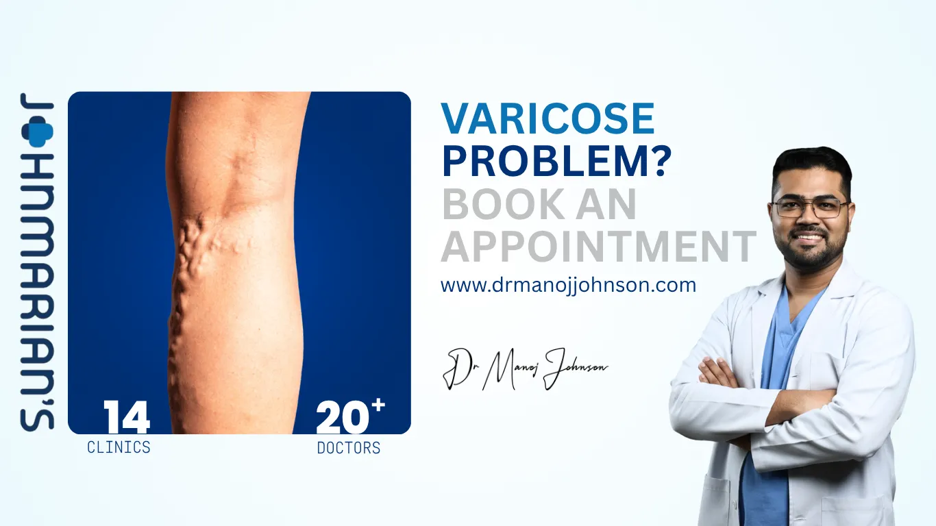 dr manoj johnson johnmarians wellness clinic varicose converted