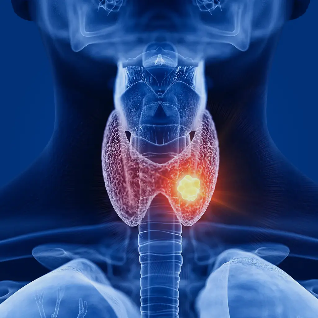 lifestyle disease thyroid page img 1